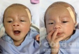Ngày về mạnh khỏe bình an của bé trai bị dao đâm vào đầu