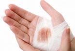 Cách cầm máu vết thương nhanh chóng, hiệu quả