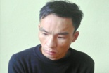 Tên trộm liều lĩnh chống trả, nhiều công an bị thương