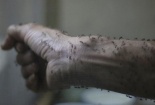 Virus Zika gây dị tật thai nhi lây lan nhanh