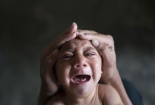 Virus Zika ăn não người: Nguy cơ lan tới Hà Nội là rất lớn
