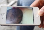 Bé sơ sinh bị mổ trúng đầu hiện đang rất yếu