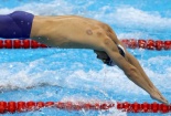 Khi kình ngư Michael Phelps cũng nhờ cậy… giác hơi