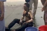Hà Nội: Nổ trạm biến áp, 5 người bị bỏng nặng