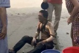 Trạm biến áp nổ: Sai lầm nghiêm trọng khi sơ cứu người bị bỏng 