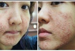 Nguy cơ mặt hóa 'ác quỷ' vì lạm dụng mỹ phẩm trôi nổi