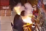 Người thợ bỏng mặt, suýt hỏng mắt vì nổ pin điện thoại