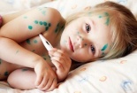Bệnh thủy đậu: Sai lầm cực kỳ nguy hiểm trong phòng tránh bệnh