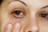 Bệnh đau mắt đỏ tăng mạnh sẽ không loại trừ ai nếu chủ quan