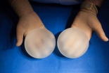 Mỹ cảnh báo: Túi nâng ngực sillicon có thể gây ung thư hiếm gặp