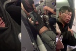 Không phải lần đầu tiên United Airlines hành xử thiếu chuyên nghiệp?