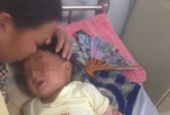 Ăn nhầm hóa chất bé 3 tuổi bỏng miệng, thực quản, dạ dày