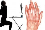 Dân văn phòng tự ý sử dụng thuốc chữa bệnh đau xương khớp có thể bị tàn phế
