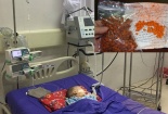 Mẹ đã biết vì sao con uống thuốc cam bị ngộ độc?