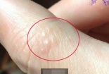 Những dấu hiệu cơ thể ai cũng từng gặp nhưng lại không biết nguyên do