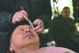 Rợn người xem làm sạch tròng mắt bằng dao cạo của người Trung Quốc