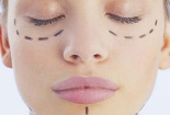 Phẫu thuật thẩm mỹ 'tự làm' gây ra biến dạng nguy hiểm