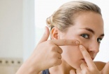 Mặt bị 'tàn phá' vì dùng kháng sinh trị mụn sai cách