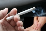 Hút thuốc lá có thể gây viêm da cơ địa khó chữa