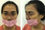Cẩn thận với dịch vụ phẫu thuật thẩm mỹ của Spa 'vườn'