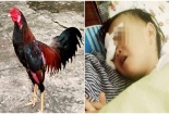 Bé 2 tuổi bất ngờ bị gà chọi 'tung cước' hỏng một mắt