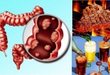 Muốn không bị ung thư trực tràng hãy tránh xa những thực phẩm này