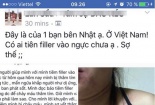 Một cô gái sau khi tiêm filler làm đẹp: Ngực căng tức, bầm tím
