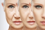 Mỹ phẩm chứa corticoid khiến nhan sắc tàn phai với tốc độ 'chóng mặt'