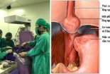Mẹ bầu cảnh giác với căn bệnh khiến dạ dày, quai ruột 'chui nhầm' lên phổi ở trẻ nhỏ
