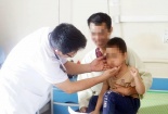 Lạm dụng thuốc Corticoid bé trai 5 tuổi bị suy thượng thận