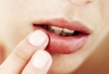 Những cách đơn giản 'cứu' đôi môi không bị nứt nẻ vào mùa Đông