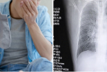 Thói quen ngửi tất bẩn khiến người đàn ông mắc viêm phổi