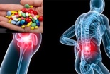 Lạm dụng thuốc giảm đau xương khớp coi chừng biến chứng khó lường