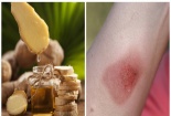 Tức ngực, khó thở nếu dùng tinh dầu sai cách để giữ ấm cơ thể ngày lạnh 
