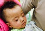 Thời tiết trở lạnh, bệnh sởi bùng phát nguy cơ ảnh hưởng tới trẻ nhỏ và bà bầu
