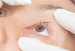 Bác sĩ cảnh báo bệnh viêm kết mạc vào mùa Đông - Xuân