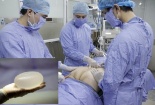Bị ung thư di căn nghi do nâng mông thẩm mỹ chỉ sau một năm