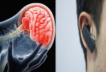 Cảnh báo nguy hiểm: Tai nghe Bluetooth có thể gây tổn thương não và ung thư?