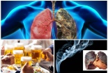 Bệnh ung thư phổi mà nghệ sĩ Lê Bình mắc phải nguy hiểm và cách phòng tránh thế nào?