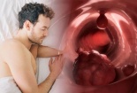 Cảnh báo nguy hiểm: Đổ mồ hôi ban đêm có thể là dấu hiệu của bệnh ung thư