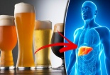 Dấu hiệu cảnh báo gan bị tổn thương không bao giờ được xem nhẹ do sử dụng rượu bia