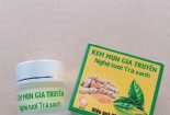 Thu hồi sản phẩm Kem trị mụn gia truyền lưu thông trên thị trường sai quy định