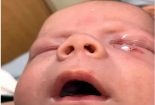 Bé sơ sinh suýt hỏng mắt sau những nụ hôn trong ngày rửa tội
