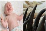 Dùng bột sừng tê giác chữa sốt co giật ở trẻ có thể gây tử vong