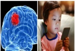 Trẻ nghiện điện thoại có nguy cơ mắc bệnh u não cao gấp 5 lần