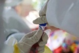 Chuẩn bị thử nghiệm thuốc điều trị HIV cho virus corona