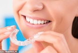 Tuyệt đối không dùng niềng răng tự làm kẻo tiền mất tật mang
