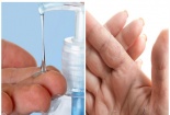 Dị ứng, hỏng da tay nếu dùng nước rửa tay khô kém chất lượng