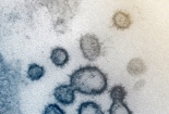 Thuốc điều trị HIV không có tác dụng chữa Covid-19