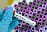 Tìm thấy kháng thể đặc biệt từ 17 năm trước giúp ngăn chặn virus corona hiệu quả
